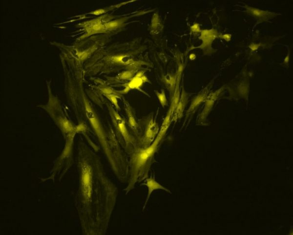 340nm LED illumination system provides the optimum excitation wavelengths for Fura-2-based calcium imaging