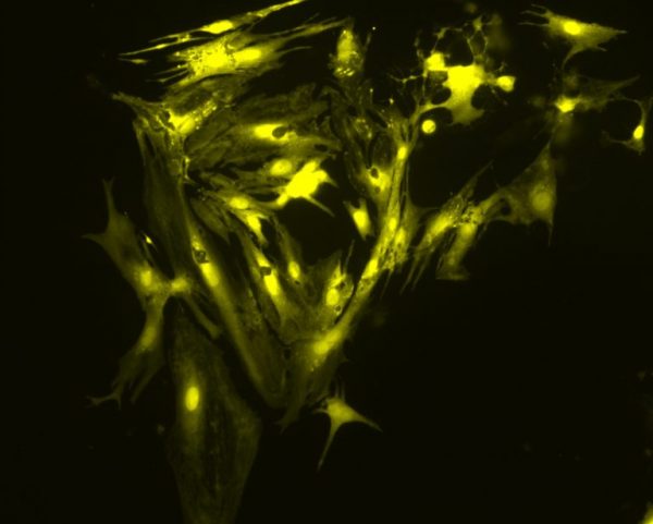 380nm LED illumination system provides the optimum excitation wavelengths for Fura-2-based calcium imaging